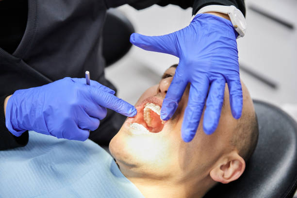 Best 24-Hour Emergency Dentist in Carrboro, NC